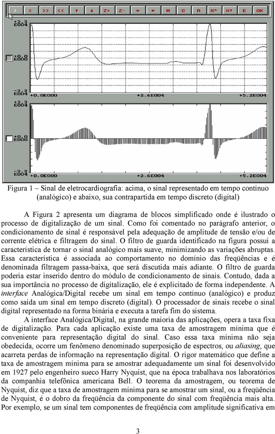 Como foi comentado no parágrafo anterior, o condicionamento de sinal é responsável pela adequação de amplitude de tensão e/ou de corrente elétrica e filtragem do sinal.