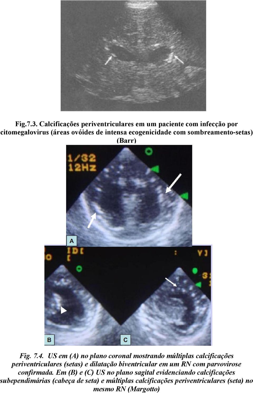 com sombreamento-setas) (Barr) Fig. 7.4.