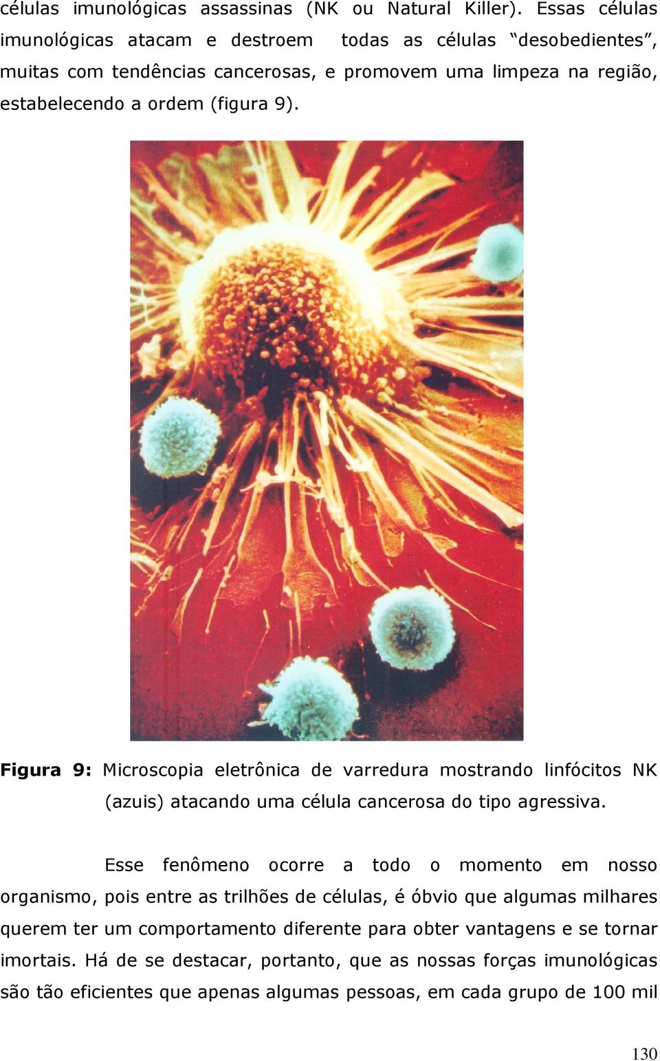 9). Figura 9: Microscopia eletrônica de varredura mostrando linfócitos NK (azuis) atacando uma célula cancerosa do tipo agressiva.