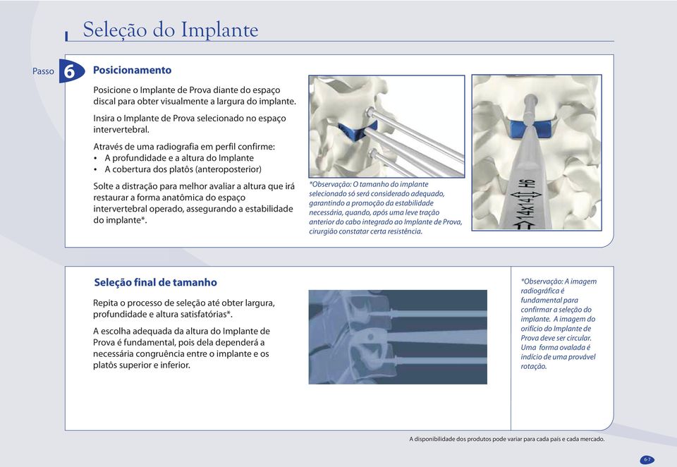 A cobertura dos platôs (anteroposterior) Solte a distração para melhor avaliar a altura que irá restaurar a forma anatômica do espaço intervertebral operado, assegurando a estabilidade do implante*.