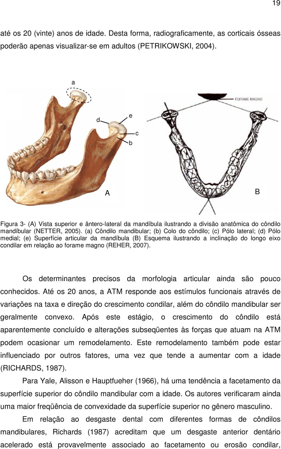 (a) Côndilo mandibular; (b) Colo do côndilo; (c) Pólo lateral; (d) Pólo medial; (e) Superfície articular da mandíbula (B) Esquema ilustrando a inclinação do longo eixo condilar em relação ao forame