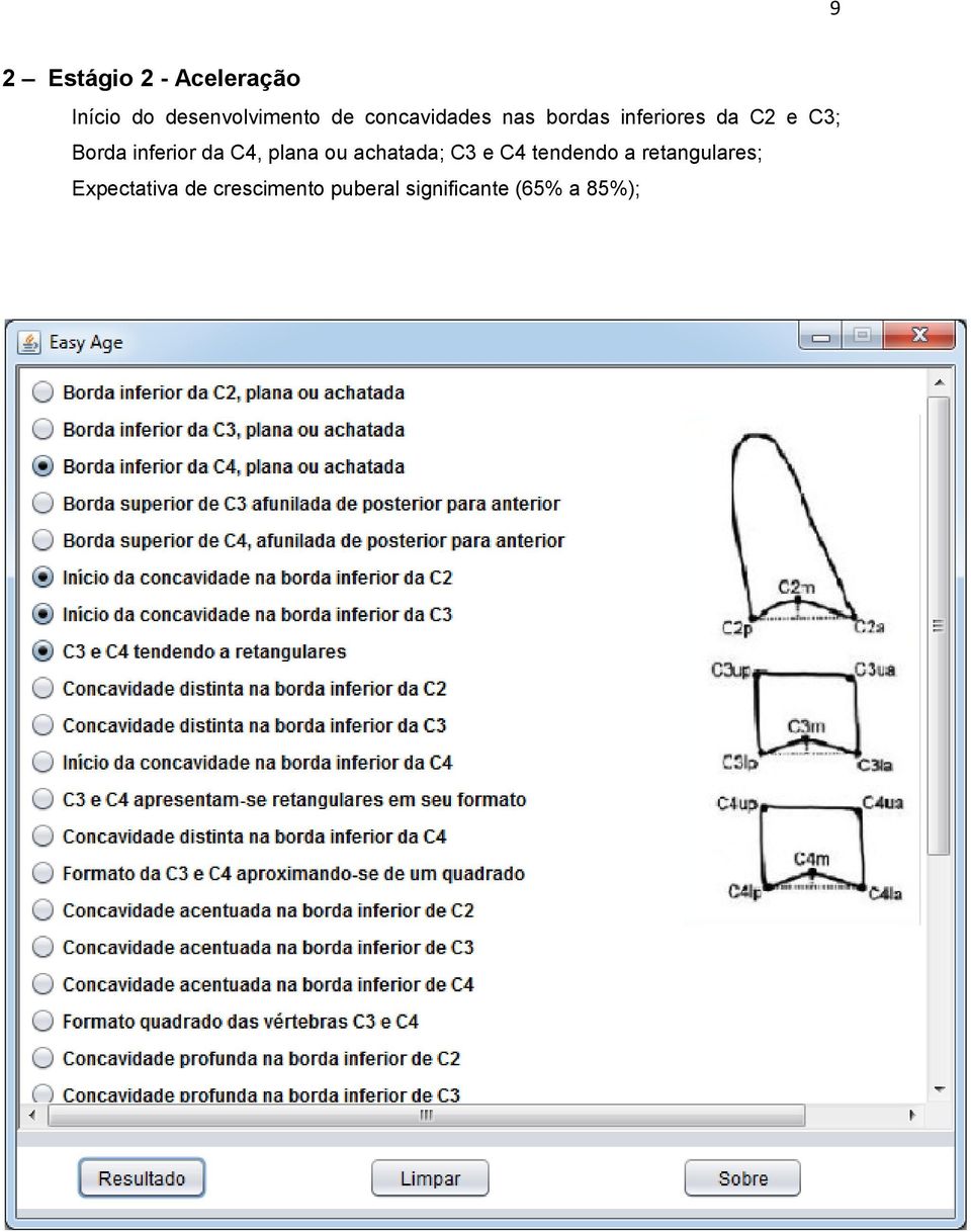 inferior da C4, plana ou achatada; C3 e C4 tendendo a