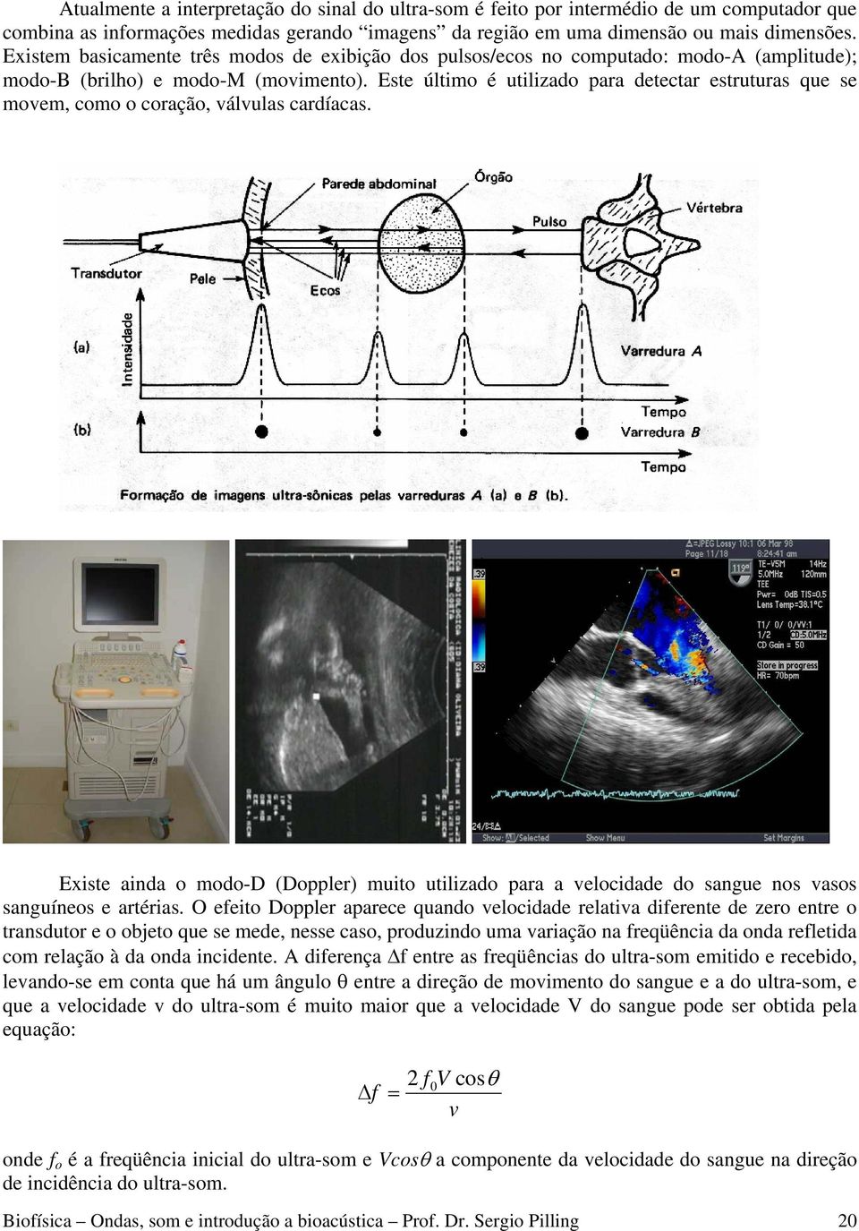 Este último é utilizado para detectar estruturas que se movem, como o coração, válvulas cardíacas.