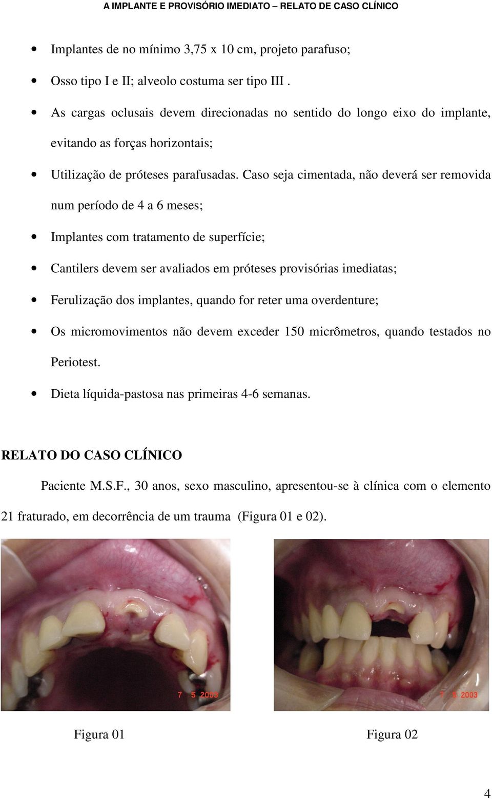 Caso seja cimentada, não deverá ser removida num período de 4 a 6 meses; Implantes com tratamento de superfície; Cantilers devem ser avaliados em próteses provisórias imediatas; Ferulização dos