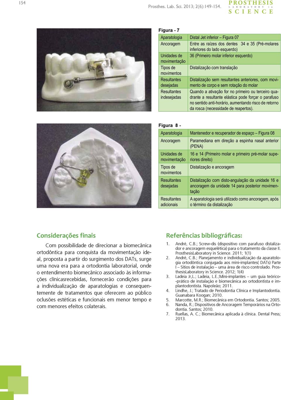 inferior esquerdo) Tipos de Distalização com translação Resultantes Distalização sem resultantes anteriores, com movimento de corpo e sem rotação do molar Resultantes Quando a ativação for no