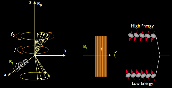 Efeitos do campo de RF sobre a magnetização Z M 0 υ 1 FIG.
