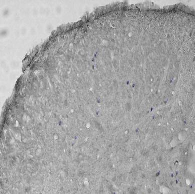 89 A Salina Veneno Veneno + LBP B Figura 10 - Efeito do LBP na ativação neuronal na medula espinal de camundongos submetidos à modelo de hiperalgesia inflamatória induzida por veneno de B.