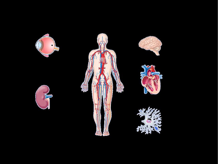 Diabetes: Complicações Major e Impacto na Saúde Retinopatia Diabética Causa principal de cegueira em adultos de meiaidade 1 Nefropatia Diabética Causa principal de Insuficiência renal crónica 2 AVC