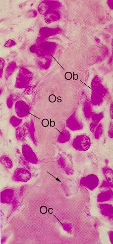 OPG/OB - produção de matriz 3- Mineralização - OTC e espículas ósseas 5- Crescimento aposicional