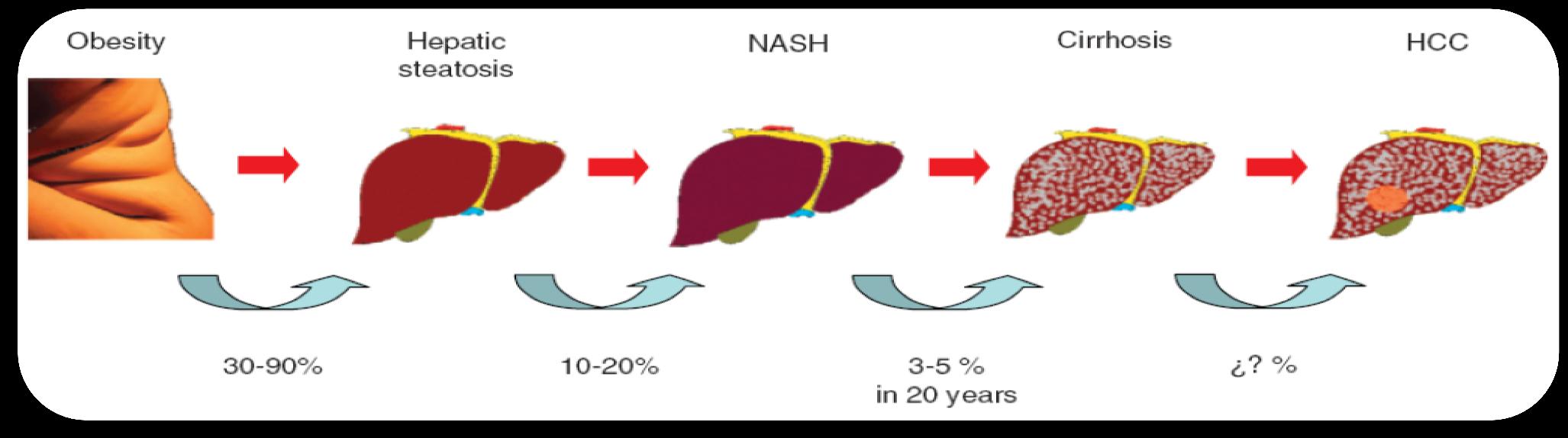 NFALD NASH / HCC Mendez-Sanchez et al.