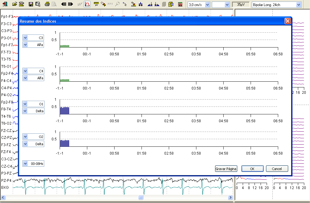 Outra inovação: monitoração com formato por índices: EEG por hora, podendo