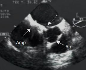 Nº Procedimentos NOVAS TECNOLOGIAS E DISPOSITIVOS NA CARDIOLOGIA DE INTERVENÇÃO Uso