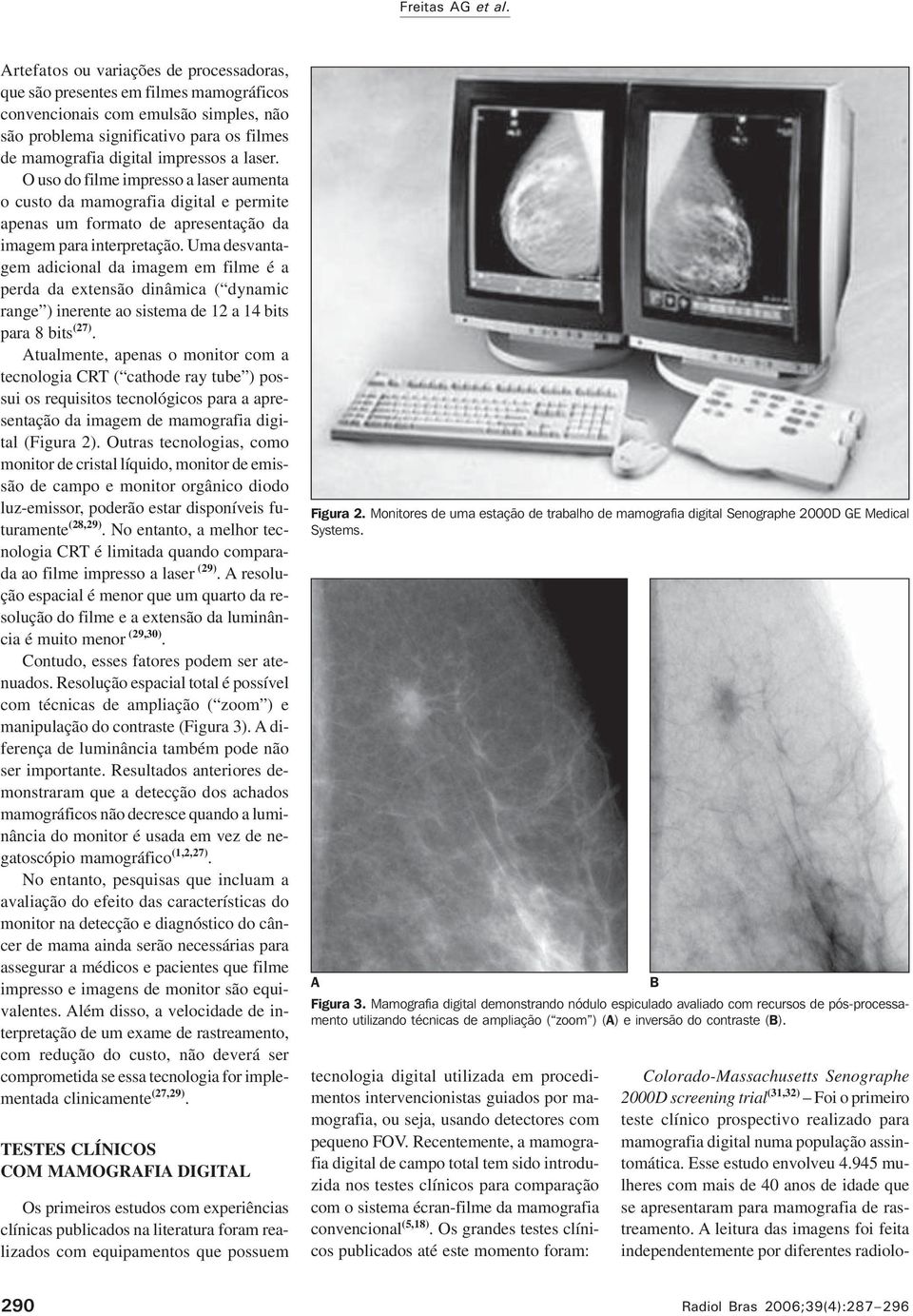laser. O uso do filme impresso a laser aumenta o custo da mamografia digital e permite apenas um formato de apresentação da imagem para interpretação.