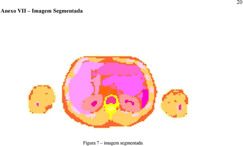 Segmentada 20