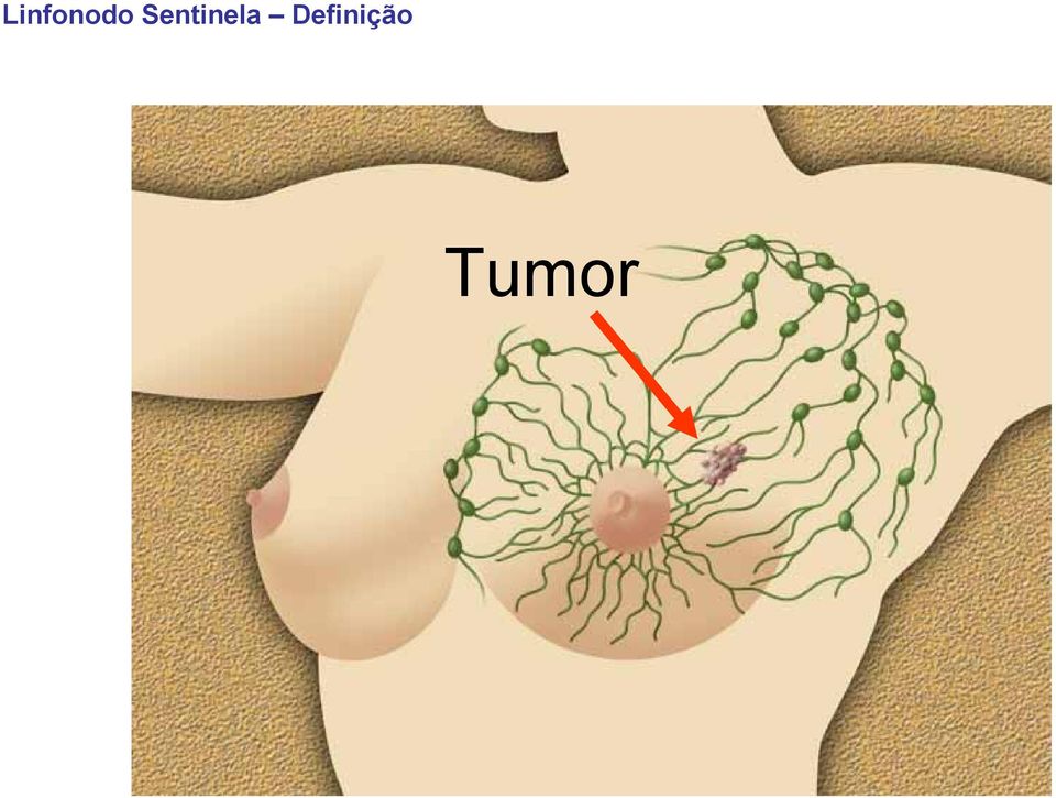 Definição