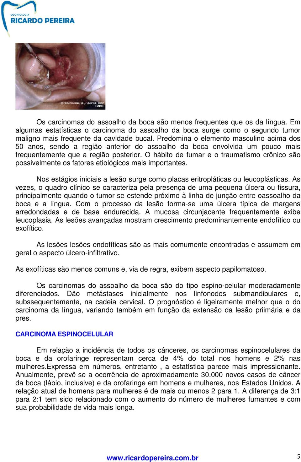 O hábito de fumar e o traumatismo crônico são possivelmente os fatores etiológicos mais importantes. Nos estágios iniciais a lesão surge como placas eritropláticas ou leucoplásticas.