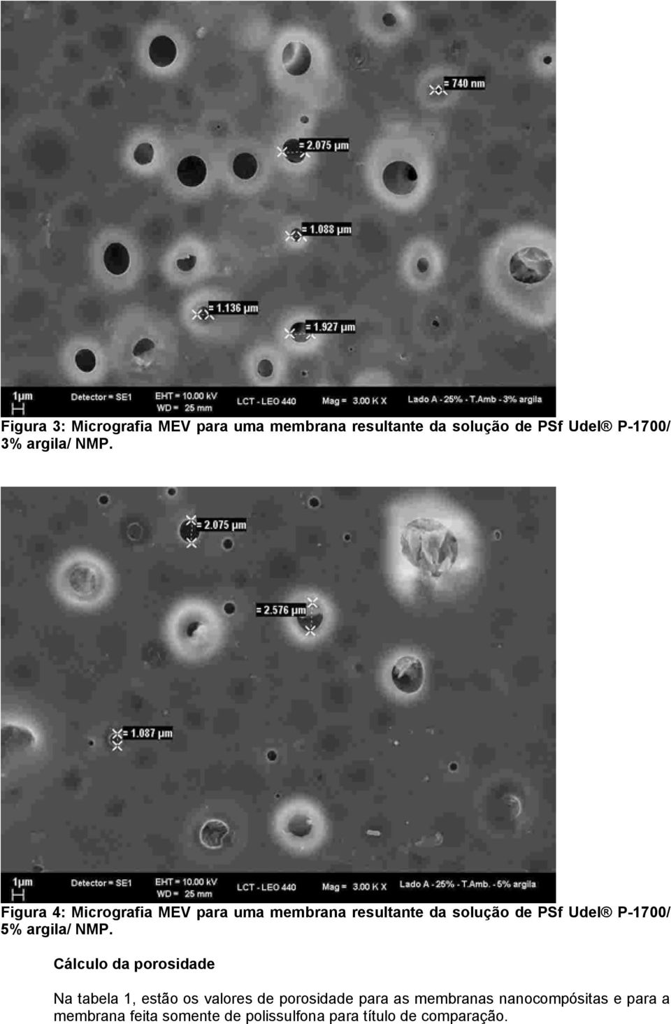 Figura 4: Micrografia MEV para uma membrana resultante da solução de PSf Udel P-1700/ 5% 