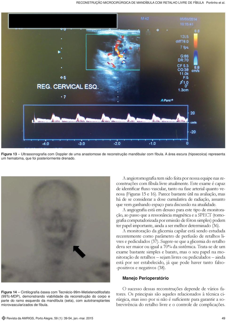 Este exame é capaz de identificar fluxo vascular, tanto na fase arterial quanto venosa (Figuras 15 e 16).