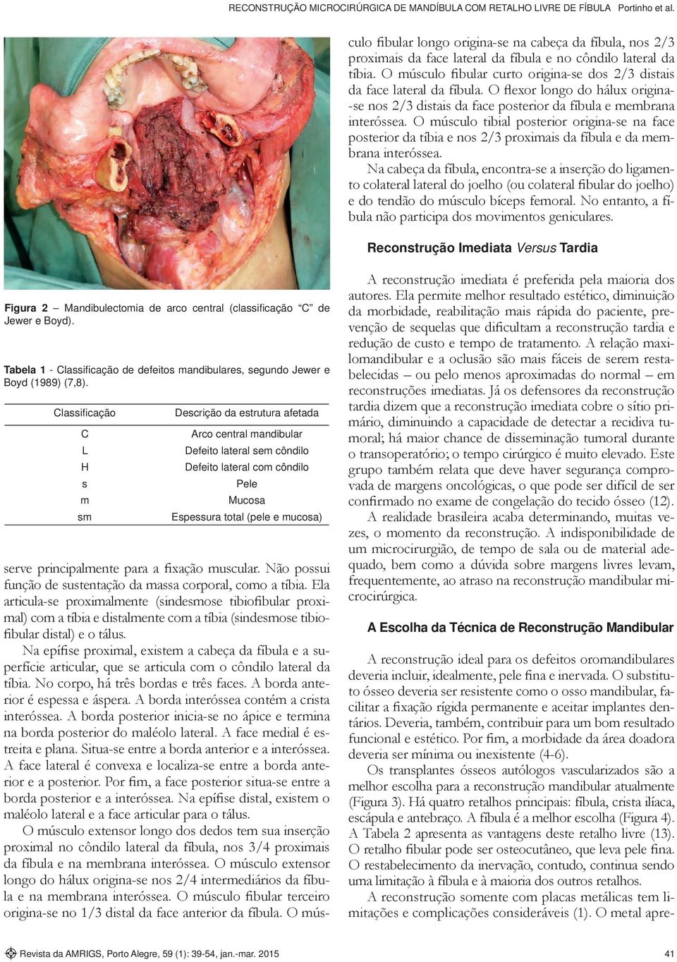 O músculo tibial posterior origina-se na face posterior da tíbia e nos 2/3 proximais da fíbula e da membrana interóssea.