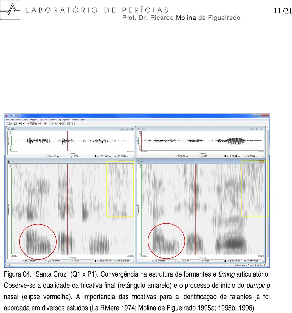 Observe-se a qualidade da fricativa final (retângulo amarelo) e o processo de início do dumping