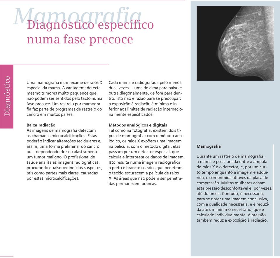 Cada mama é radiografada pelo menos duas vezes uma de cima para baixo e outra diagonalmente, de fora para dentro.