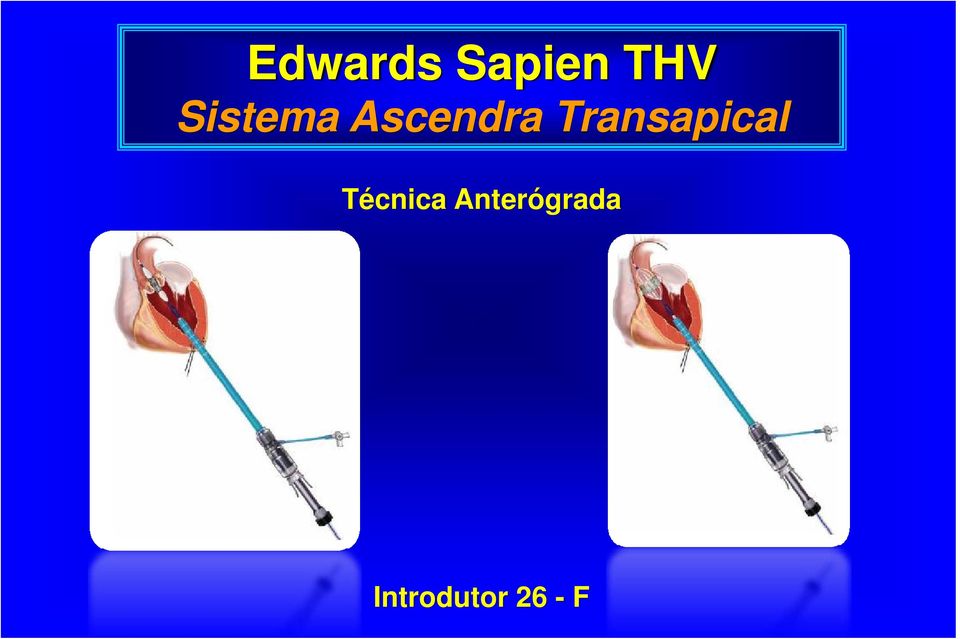 Transapical Técnica