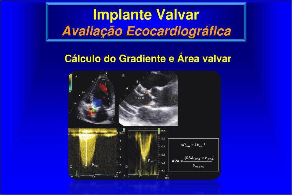 Ecocardiográfica