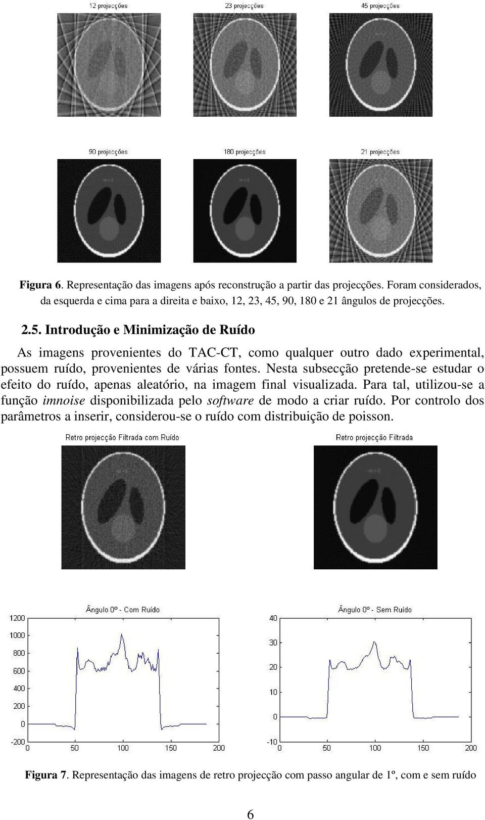 90, 180 e 21 ângulos de projecções. 2.5.