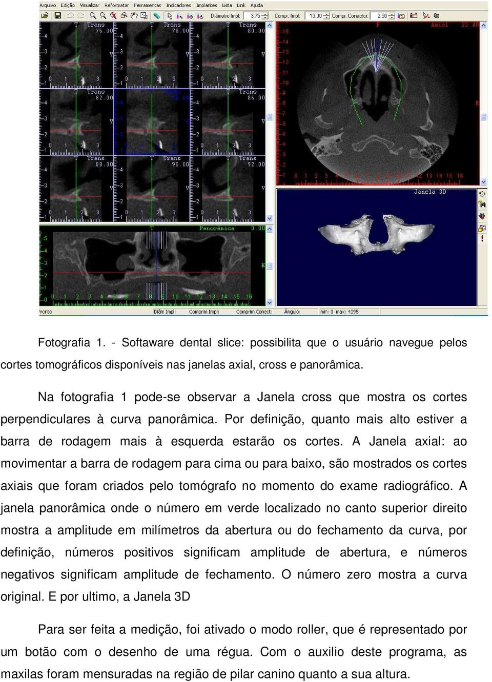 A Janela axial: ao movimentar a barra de rodagem para cima ou para baixo, são mostrados os cortes axiais que foram criados pelo tomógrafo no momento do exame radiográfico.