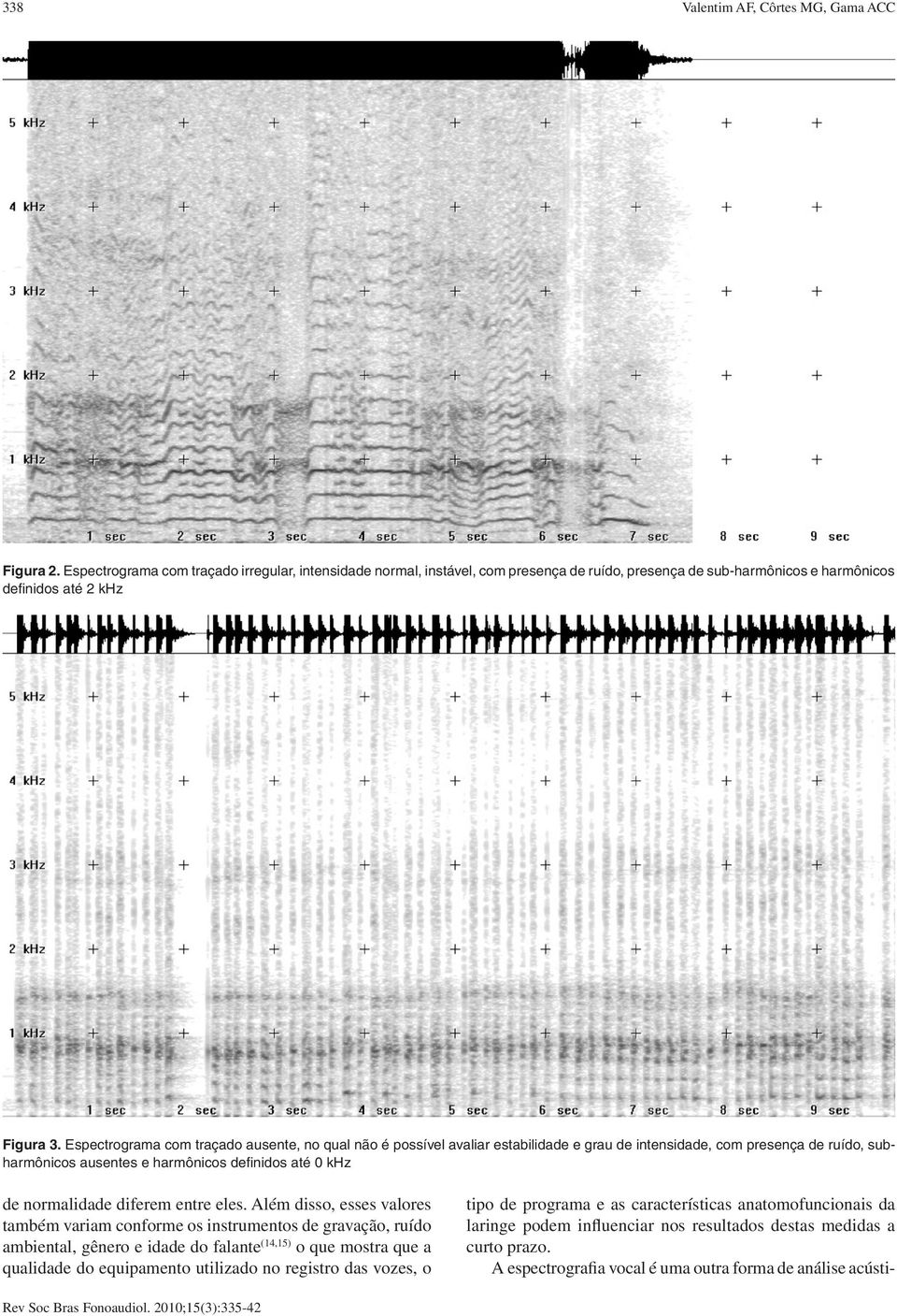Espectrograma com traçado ausente, no qual não é possível avaliar estabilidade e grau de intensidade, com presença de ruído, subharmônicos ausentes e harmônicos definidos até 0 khz de normalidade