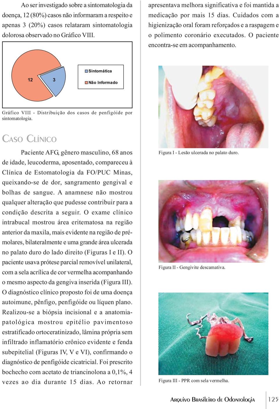 O paciente encontra-se em acompanhamento. Gráfico VIII - Distribuição dos casos de penfigóide por sintomatologia.