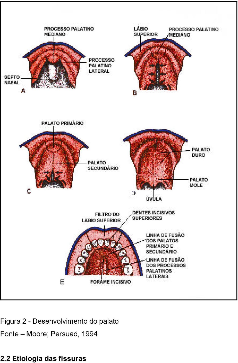 palato Fonte Moore;