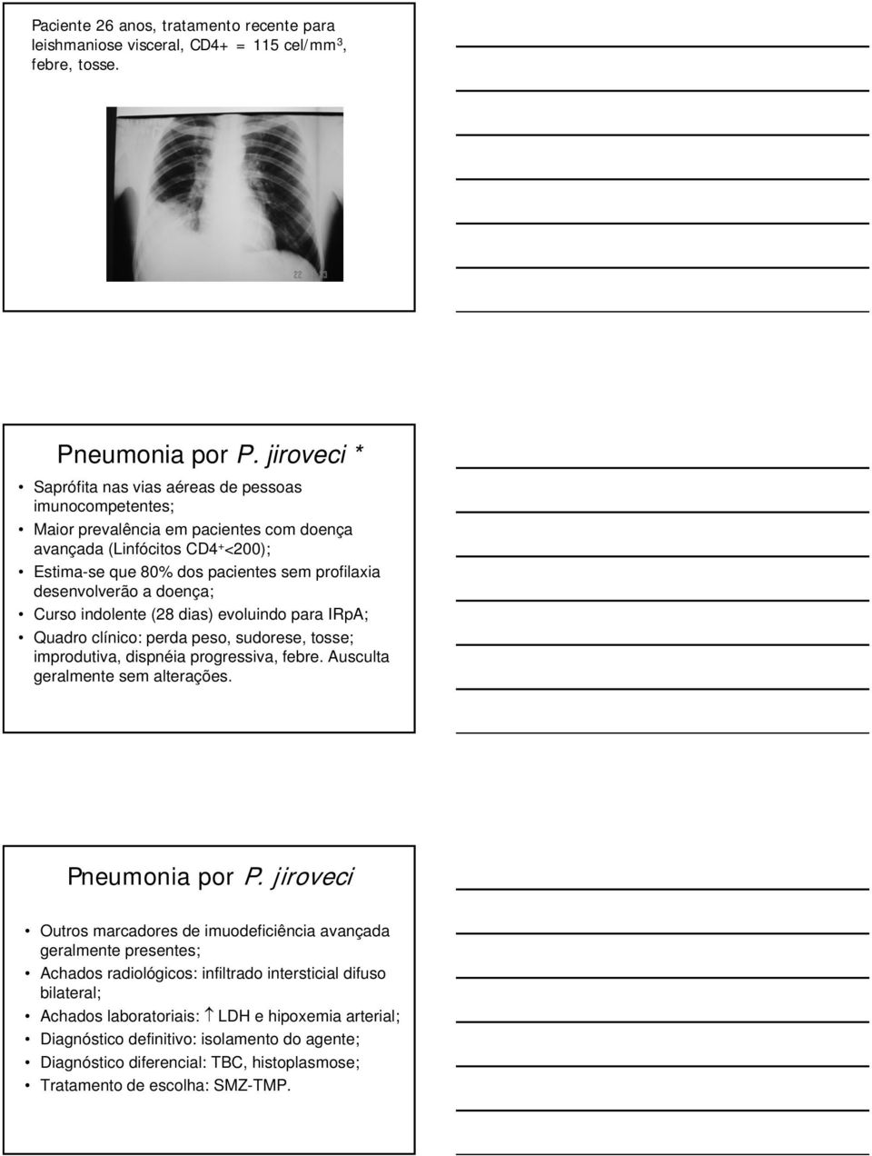 desenvolverão a doença; Curso indolente (28 dias) evoluindo para IRpA; Quadro clínico: perda peso, sudorese, tosse; improdutiva, dispnéia progressiva, febre. Ausculta geralmente sem alterações.