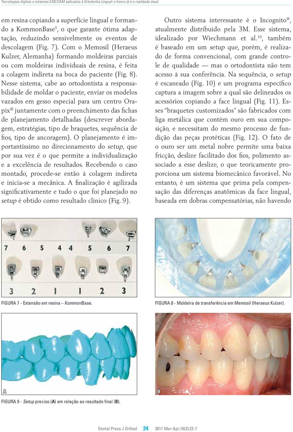 Nesse sistem, cbe o ortodontist responsbilidde de moldr o pciente, envir os modelos vzdos em gesso especil pr um centro Orpix juntmente com o preenchimento ds fichs de plnejmento detlhds (descrever