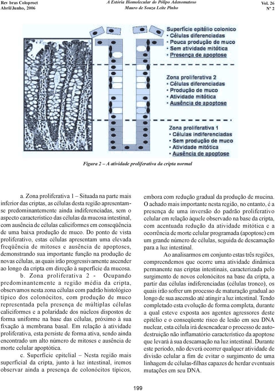 intestinal, com ausência de células caliciformes em conseqüência de uma baixa produção de muco.
