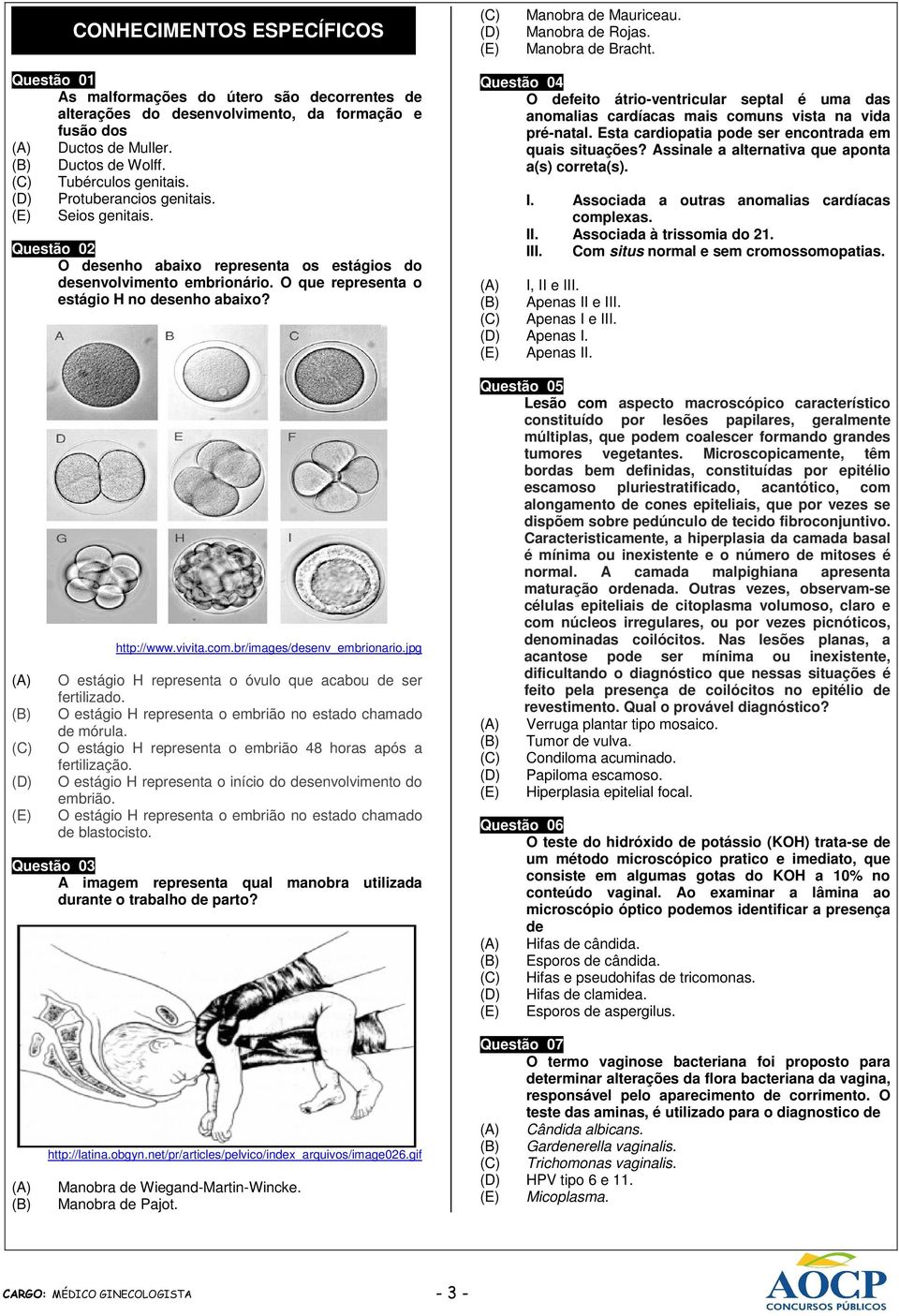 Seios genitais. Questão 02 O desenho abaixo representa os estágios do desenvolvimento embrionário. O que representa o estágio H no desenho abaixo? http://www.vivita.com.br/images/desenv_embrionario.