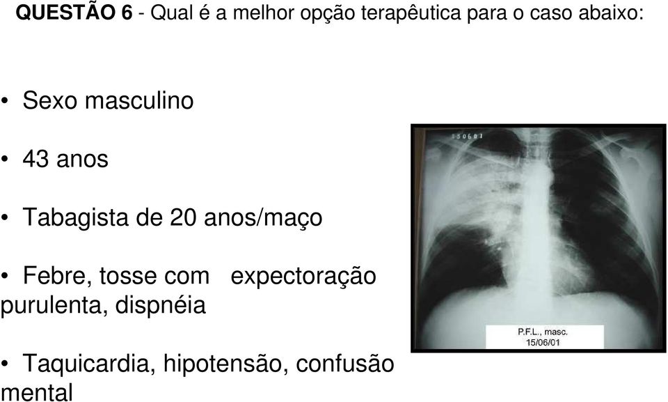 20 anos/maço Febre, tosse com expectoração