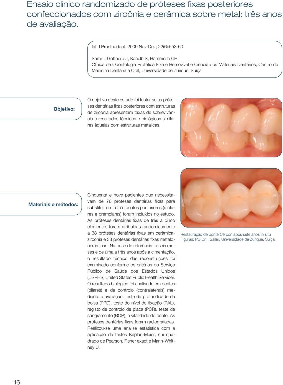 Clínica de Odontologia Protética Fixa e Removível e Ciência dos Materiais Dentários, Centro de Medicina Dentária e Oral, Universidade de Zurique, Suíça Objetivo: O objetivo deste estudo foi testar se