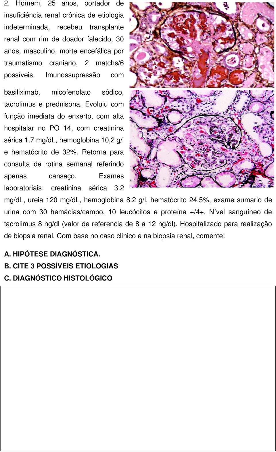 Evoluiu com função imediata do enxerto, com alta hospitalar no PO 14, com creatinina sérica 1.7 mg/dl, hemoglobina 10,2 g/l e hematócrito de 32%.