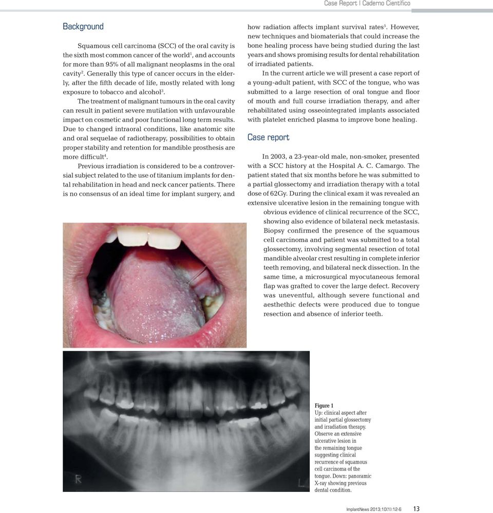 The treatment of malignant tumours in the oral cavity can result in patient severe mutilation with unfavourable impact on cosmetic and poor functional long term results.