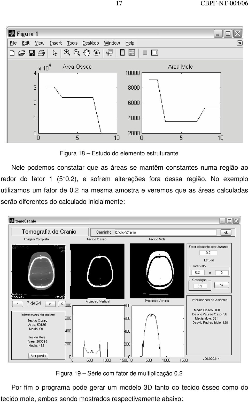 2 na mesma amostra e veremos que as áreas calculadas serão diferentes do calculado inicialmente: Figura 19 Série com fator