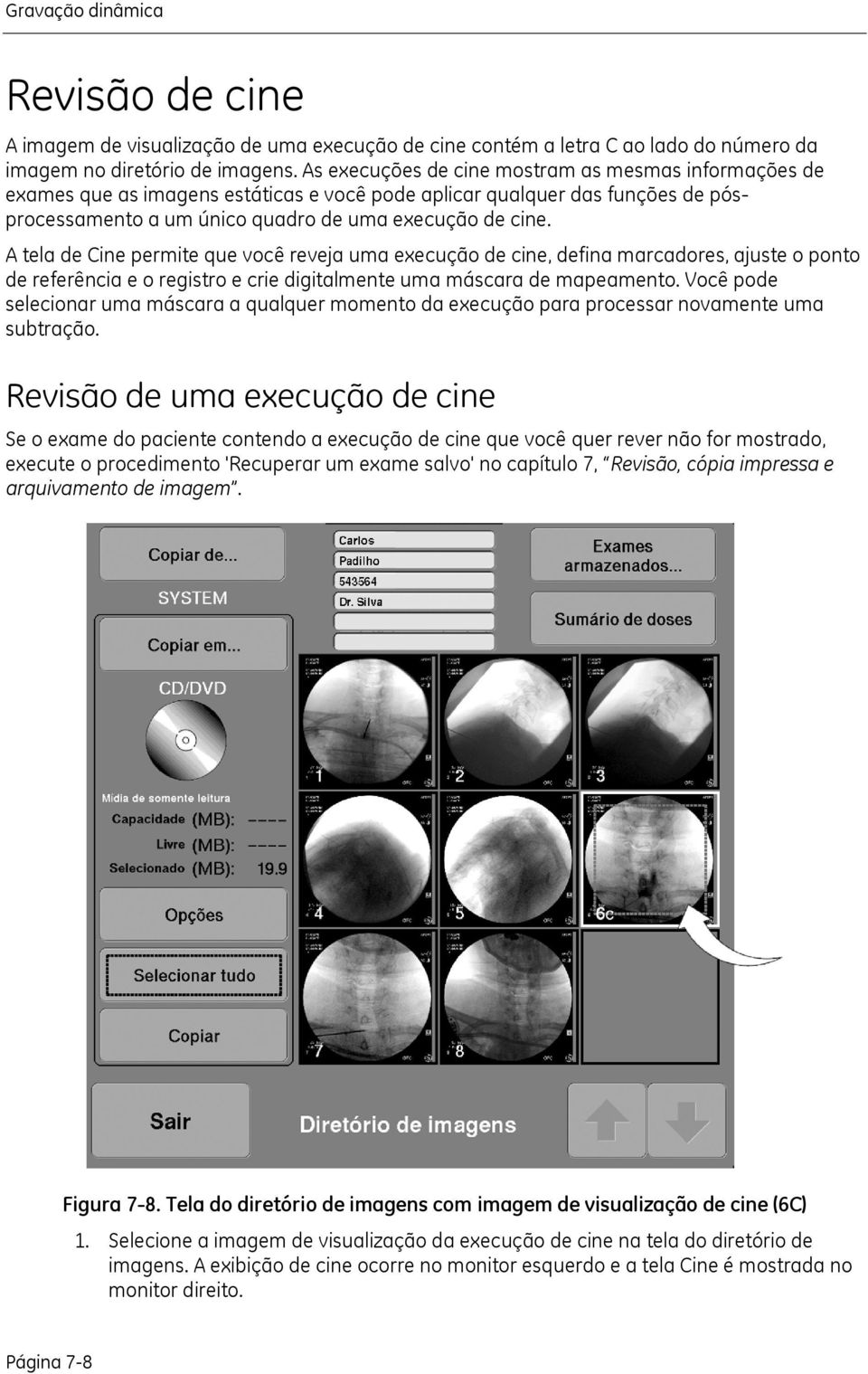 A tela de Cine permite que você reveja uma execução de cine, defina marcadores, ajuste o ponto de referência e o registro e crie digitalmente uma máscara de mapeamento.