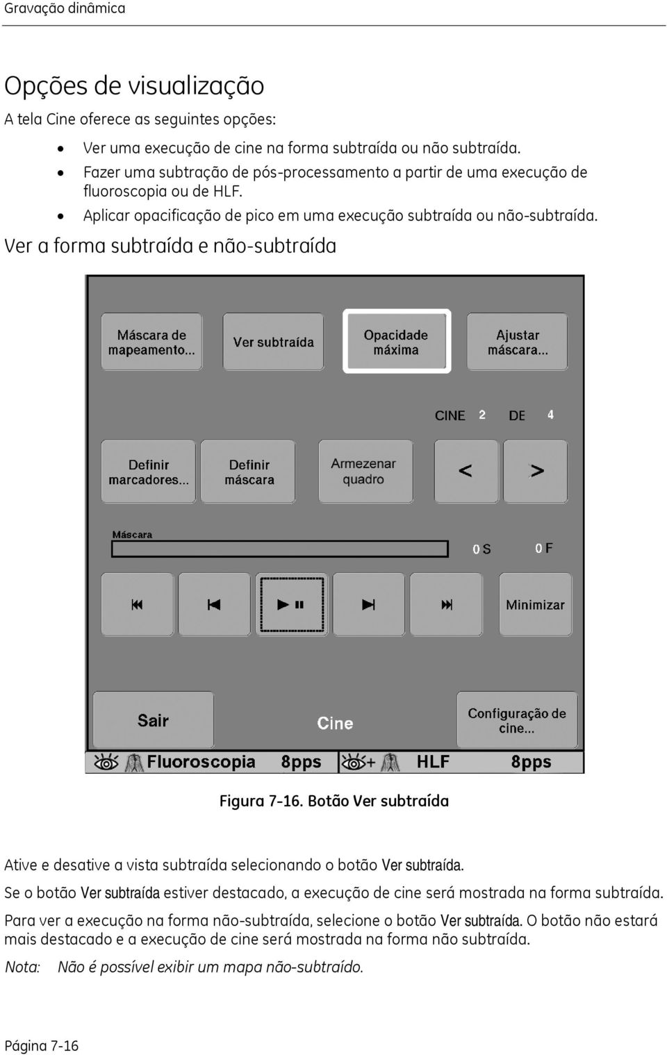 Ver a forma subtraída e não-subtraída Figura 7-16. Botão Ver subtraída Ative e desative a vista subtraída selecionando o botão Ver subtraída.