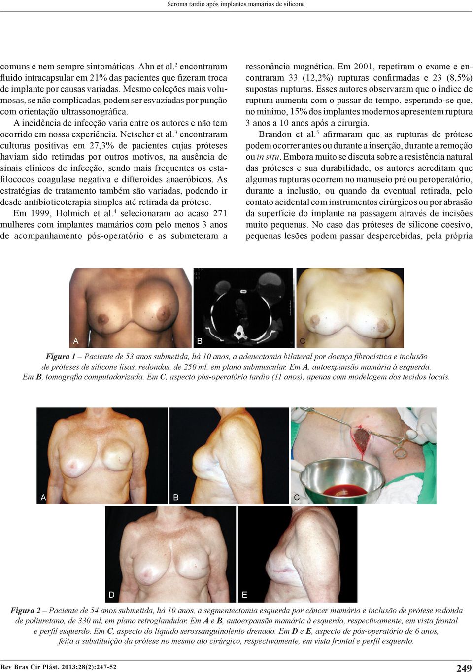 Mesmo coleções mais volumosas, se não complicadas, podem ser esvaziadas por punção com orientação ultrassonográfica.