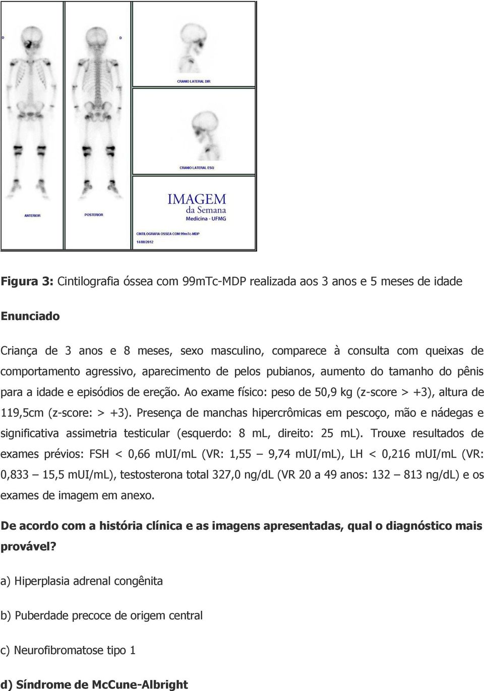 Presença de manchas hipercrômicas em pescoço, mão e nádegas e significativa assimetria testicular (esquerdo: 8 ml, direito: 25 ml).