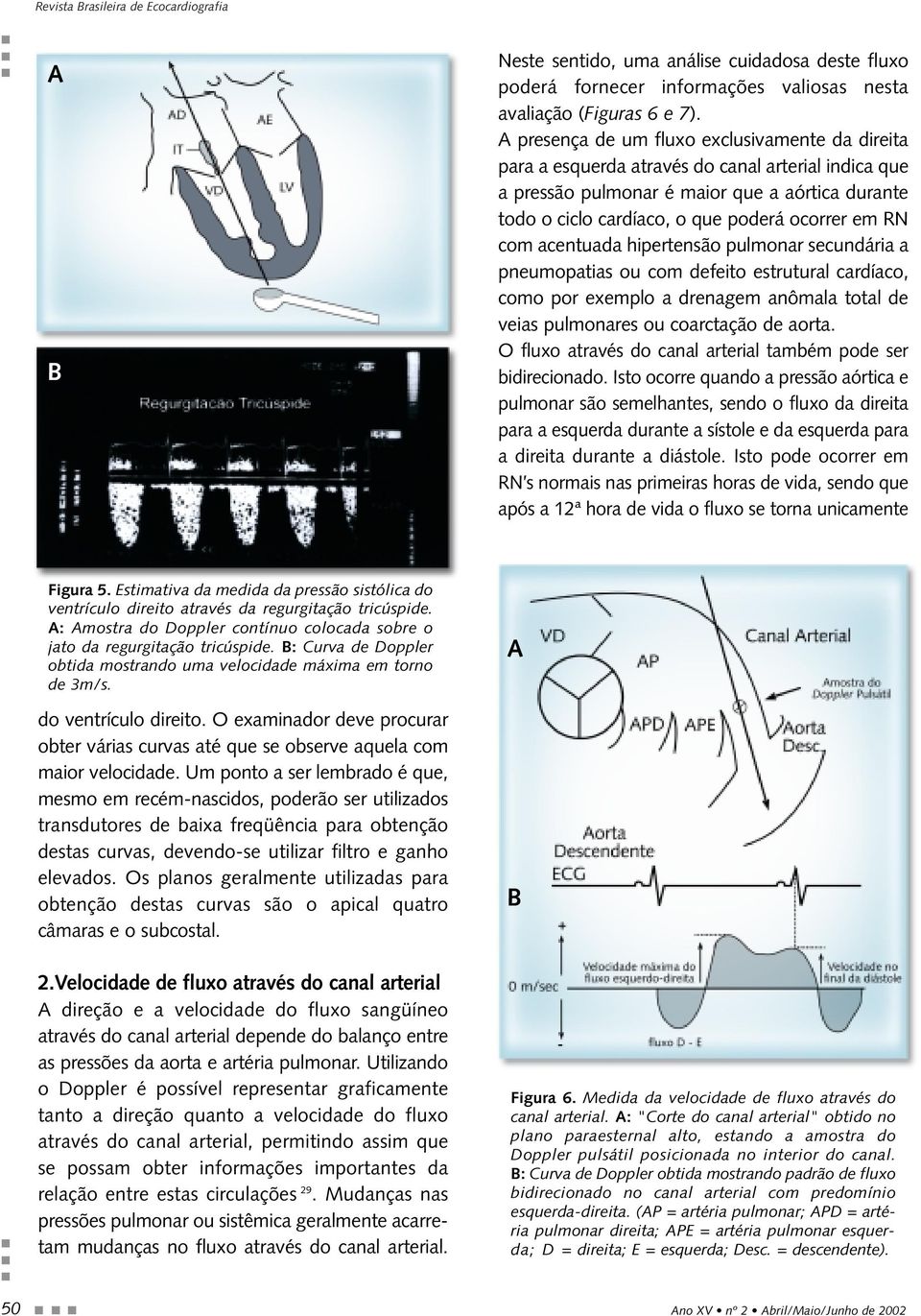 RN com acentuada hipertensão pulmonar secundária a pneumopatias ou com defeito estrutural cardíaco, como por exemplo a drenagem anômala total de veias pulmonares ou coarctação de aorta.