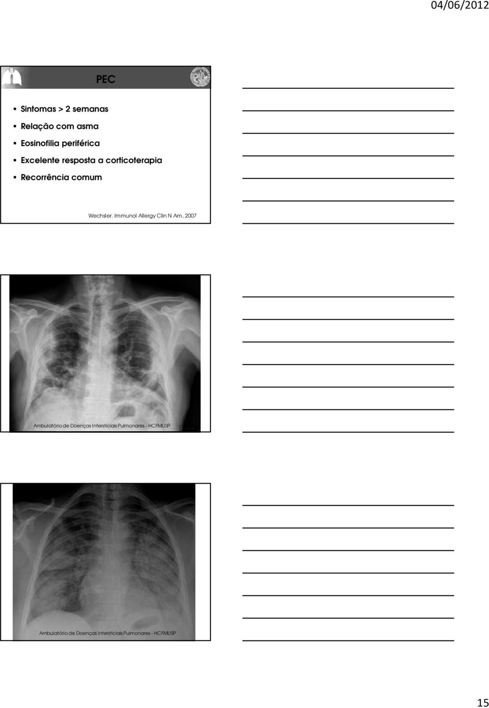 resposta a corticoterapia Recorrência