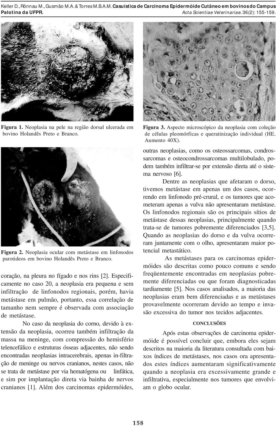 Especificamente no caso 20, a neoplasia era pequena e sem infiltração de linfonodos regionais, porém, havia metástase em pulmão, portanto, essa correlação de tamanho nem sempre é observada com