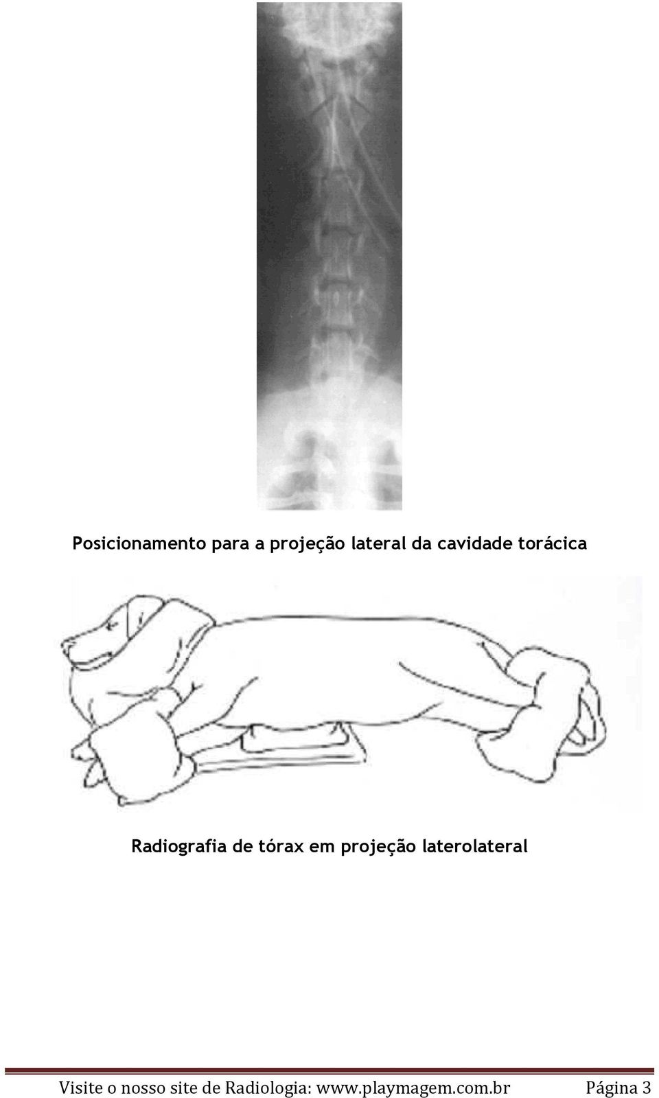 projeção laterolateral Visite o nosso site