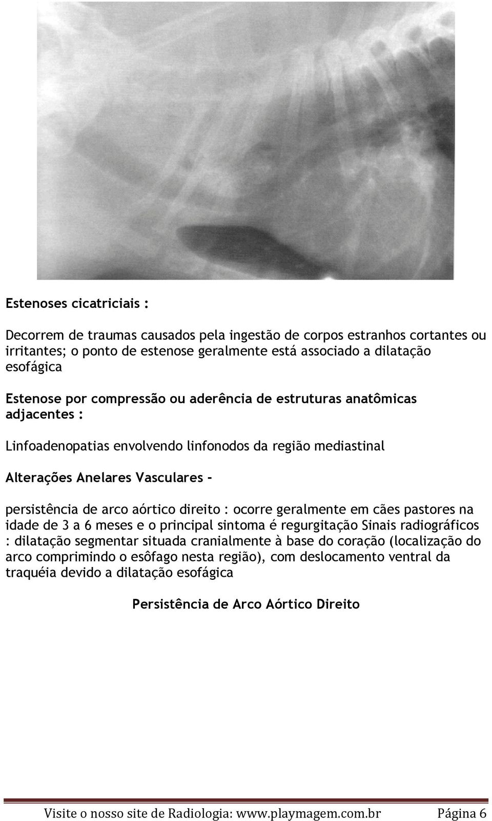 ocorre geralmente em cães pastores na idade de 3 a 6 meses e o principal sintoma é regurgitação Sinais radiográficos : dilatação segmentar situada cranialmente à base do coração (localização do